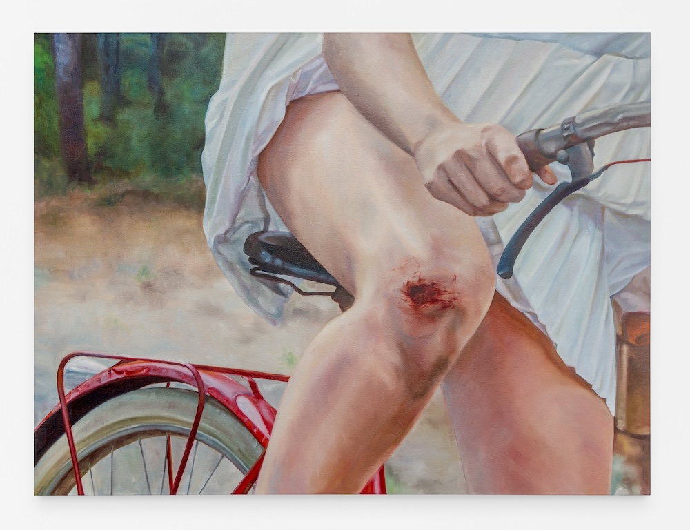 Skinned Knee, 2025 (detail) oil on linen